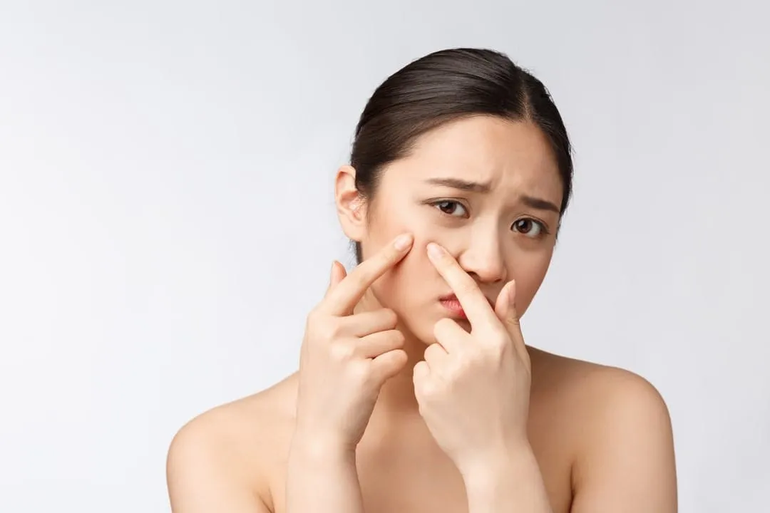 Chăm sóc da mụn